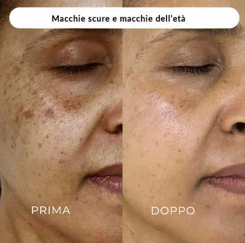 RUGHE E PELLE RILASSATA SUL COLLO